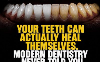 How to Support Tooth Health Naturally