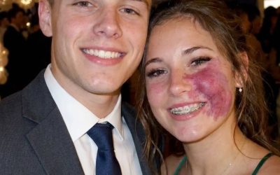 Only one boy asked me to prom because no one else wanted to go with me because of the birthmark on my face — everyone laughed until police officers walked into the gym.