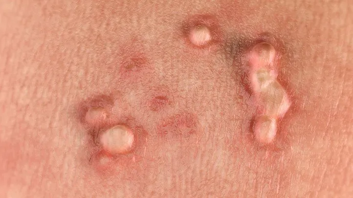 Genital Skin Changes: When to Worry and When to Relax