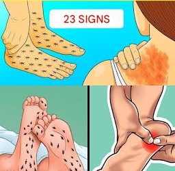 🚨 23 Warning Signs Your Kidneys May Be Asking for Help