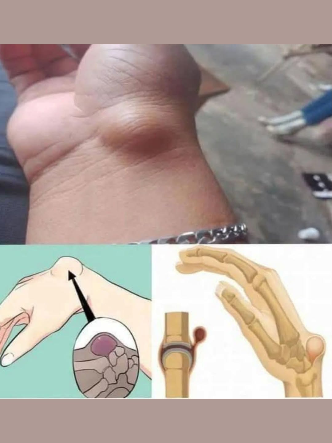 Be Careful: If You Get These Bruises on Your Body, It Might Mean Something Serious