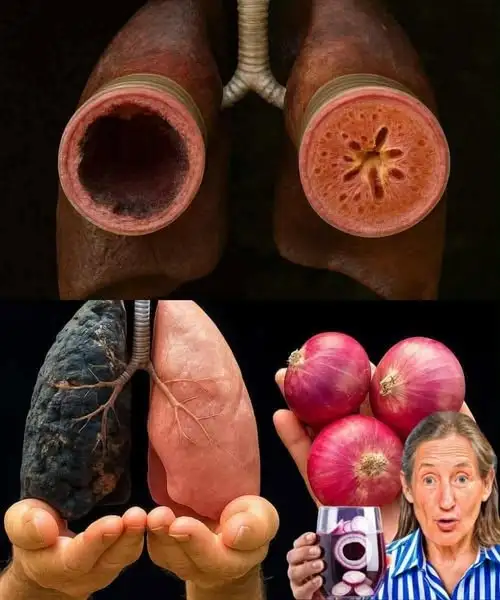 Natural Recipe to Dissolve Phlegm and Cleanse the Lungs — Feel Instant Relief!