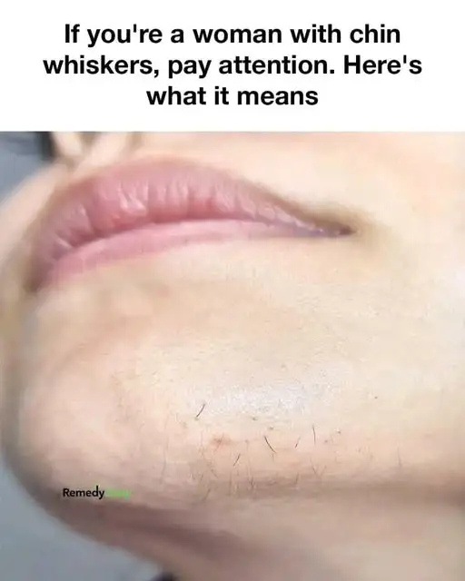 What Your Chin Whiskers Could Tell You About Your Health