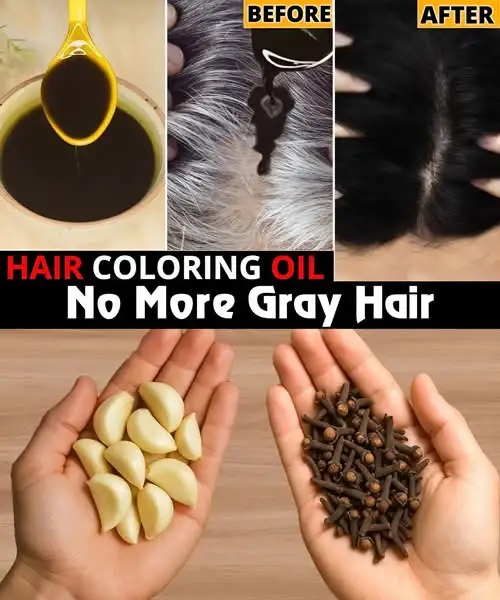 From White Hair to Black Hair Naturally in Just 5 Minutes: The Garlic & Clove Miracle