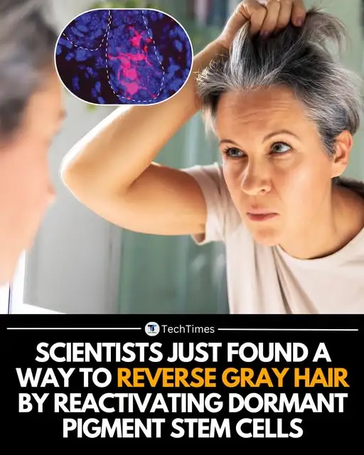 Scientists Discover a Way to Reverse Gray Hair Naturally — No Dye Needed