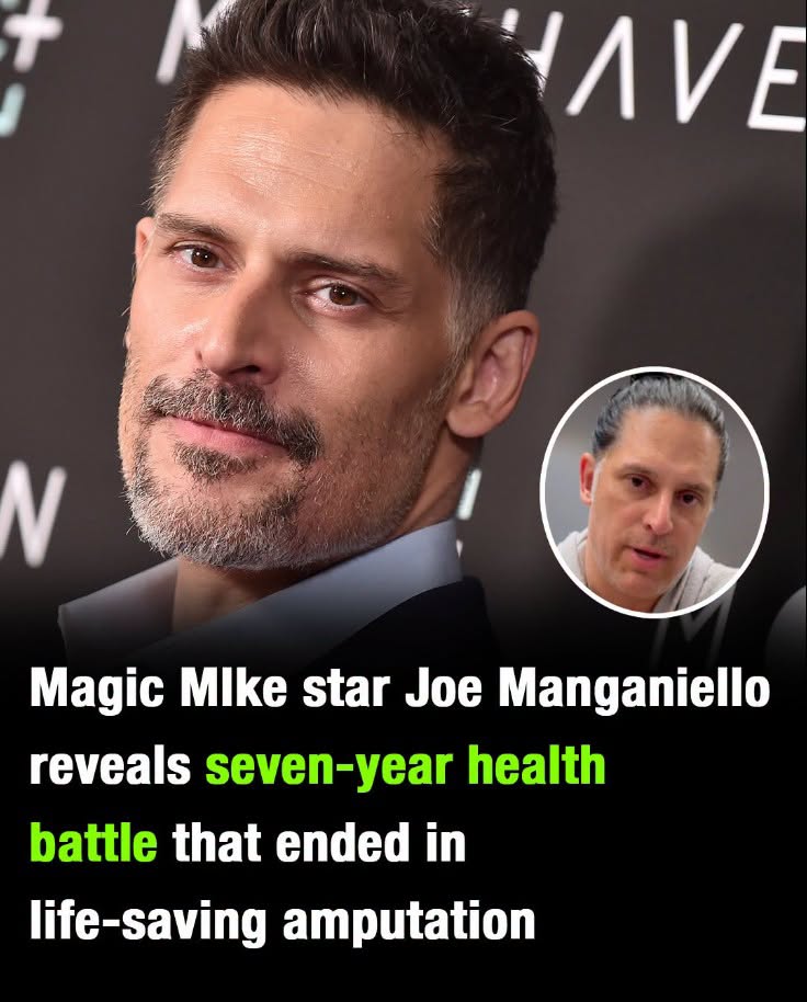 Magic Mike star Joe Manganiello reveals secret seven-year health battle that ended in life-saving amputation