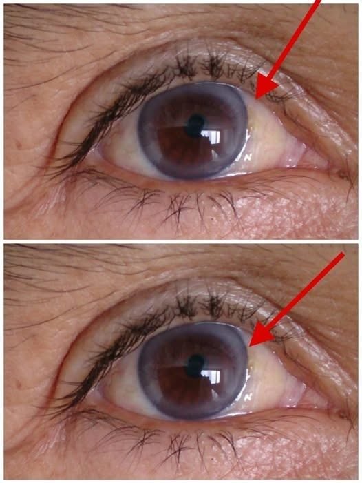 These are the first symptoms of a… See more