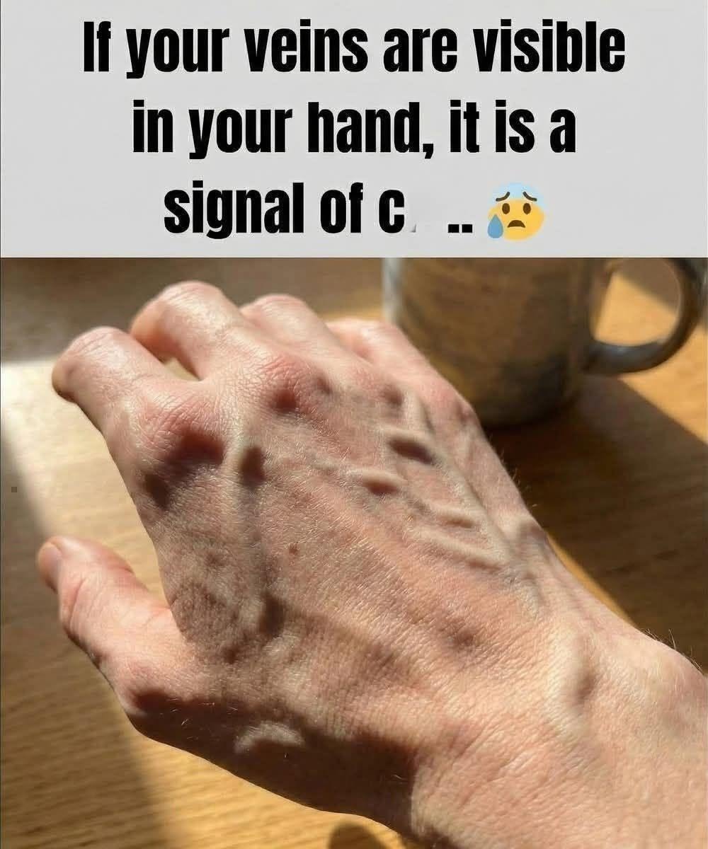 If your veins are visible, it means you are… See more