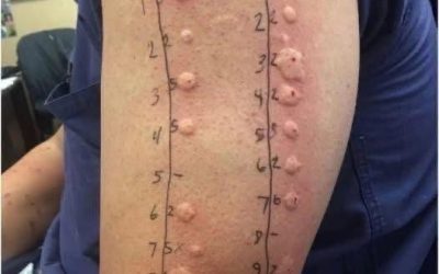 These are the consequences of sleeping with the…