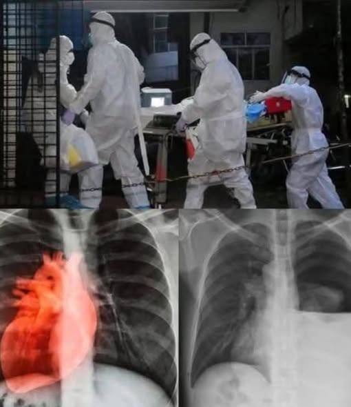 Alert COVID vaccinated may be enf… See more