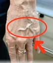 If you have visible veins, it means you are…see more
