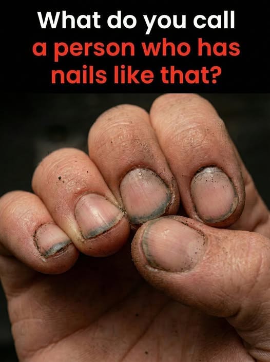 What Do You Call Someone With Nails Like That?