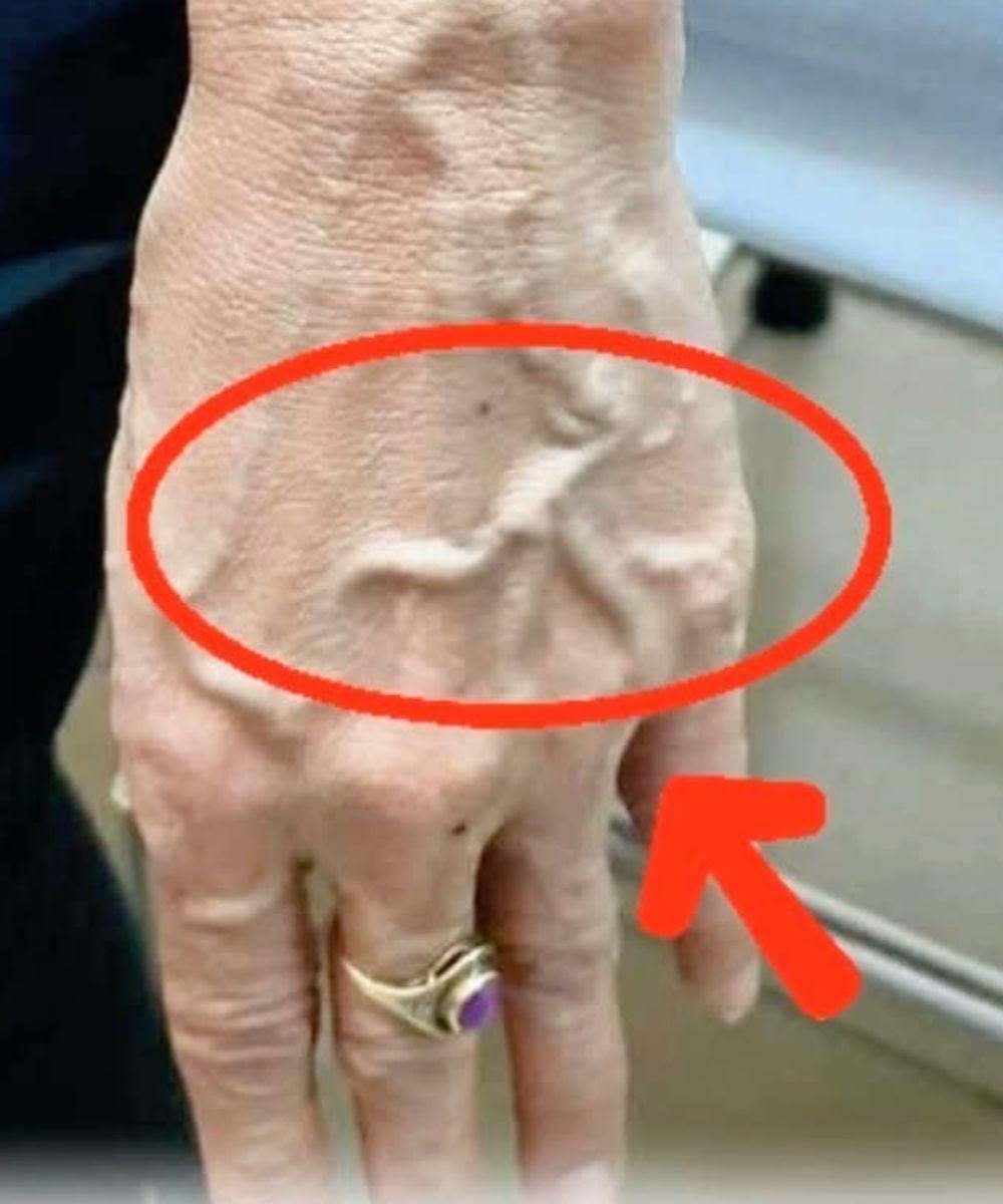 Did you know that having visible veins means you are… See more