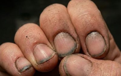 What Do You Call Someone With Nails Like That?