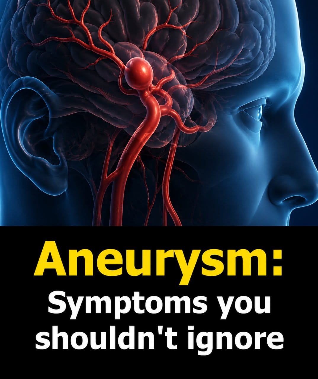 Aneurysm: Signs You Shouldn’t Ignore…