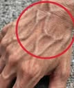 If you have visible veins, it means you are…see more below