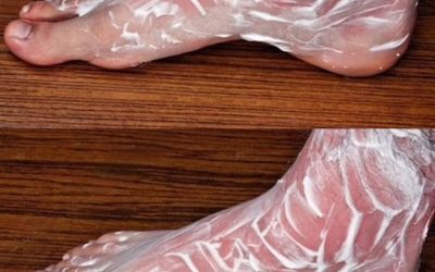 Get rid of bone and joint pain with this remedy