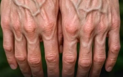 If your veins are visible, it means you are… See more
