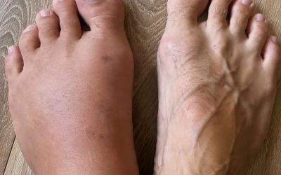 This is what happens as a result of sleeping with a… See more👇