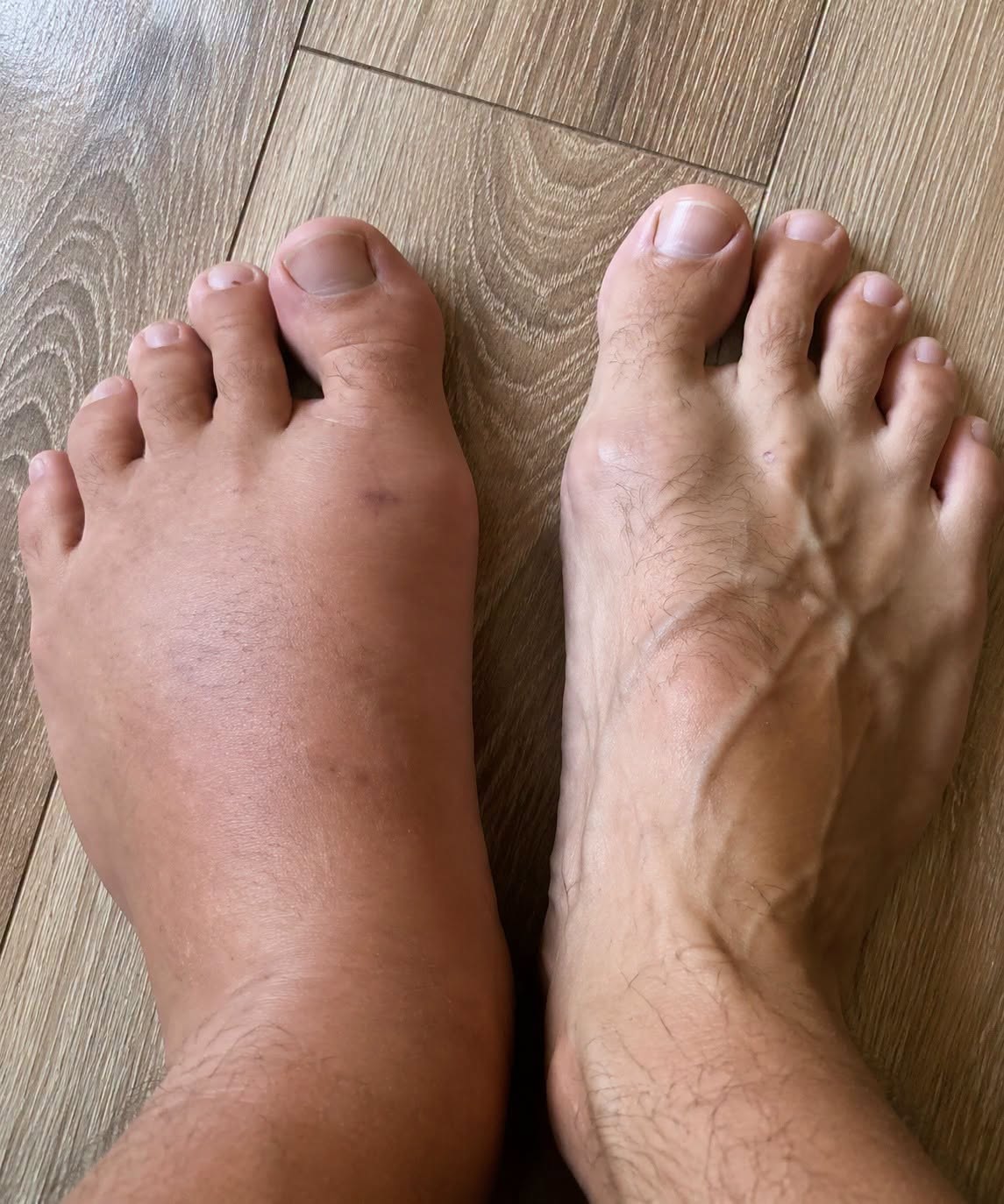 This is what happens as a result of sleeping with a… See more👇