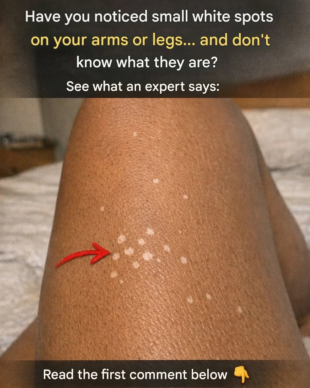 Why do white spots appear on the skin?
