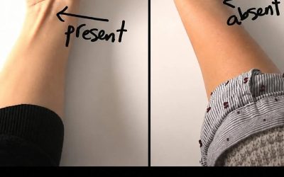 If a tendon lifts when you touch your little finger with your thumb, here’s what it means