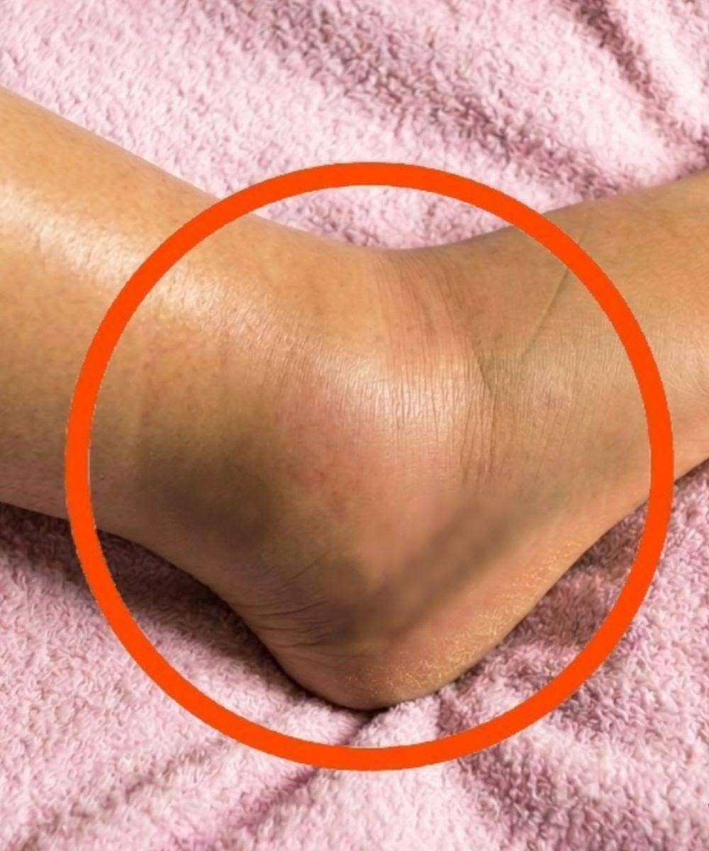 If You Notice Your Legs Are Swollen, Doctors Warn It Could Be a Sign of..see more below