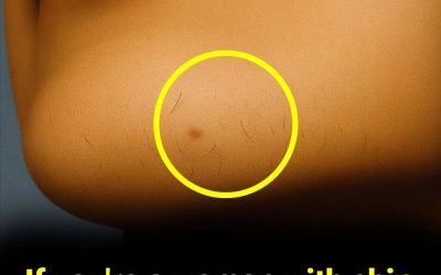 If you’re a woman with chin whiskers, pay attention
