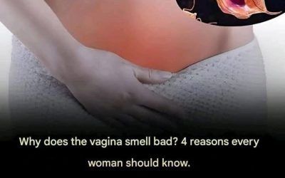 Vaginal Odor: 4 Common Causes Every Woman Should Know