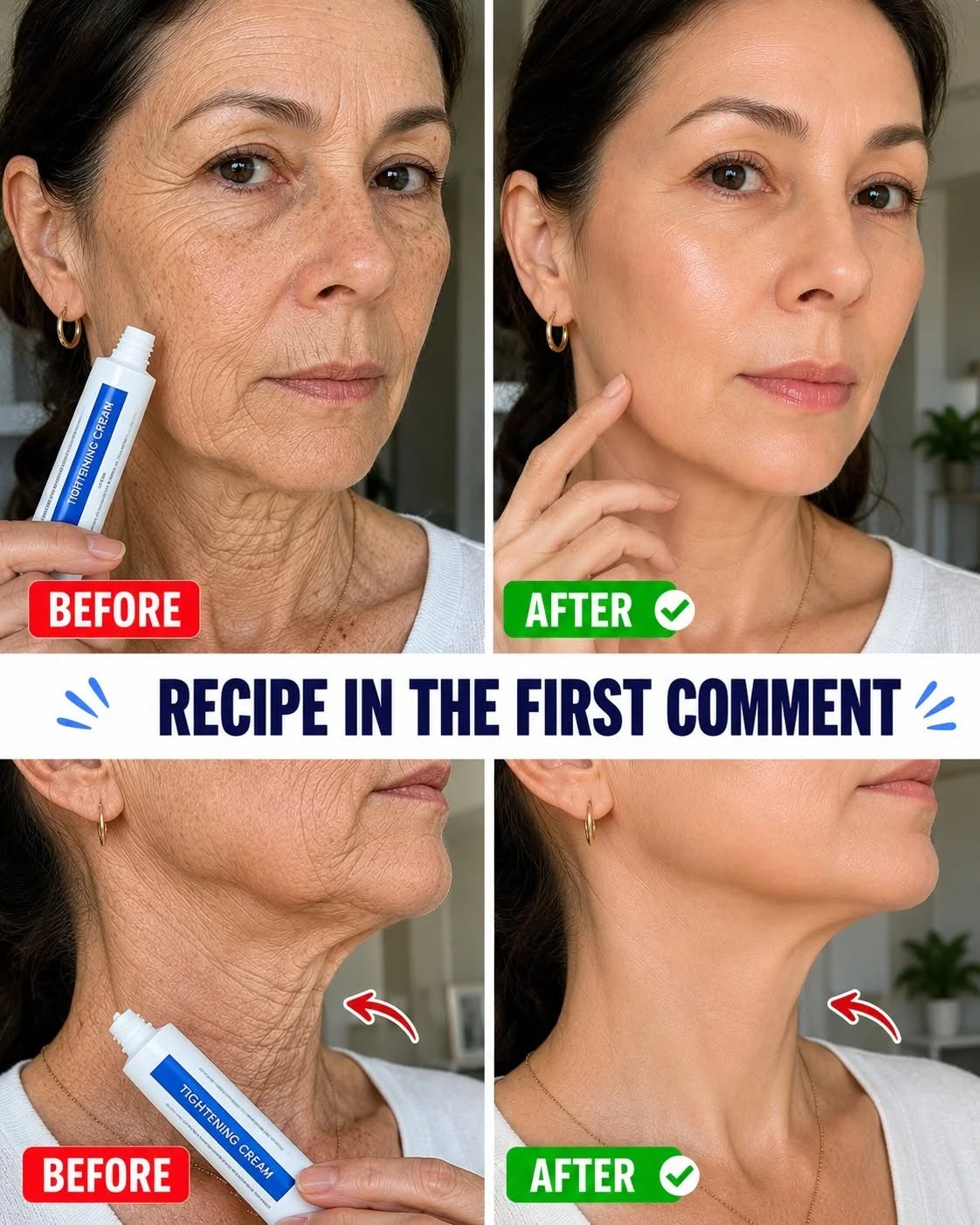 “It looks like I had plastic surgery”: The home remedy used to improve the appearance of wrinkles and dark spots on hands and arms. To