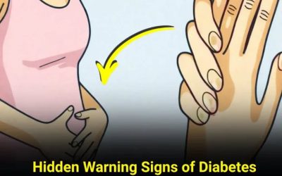 9 Warning Signs That Could Indicate Diabetes