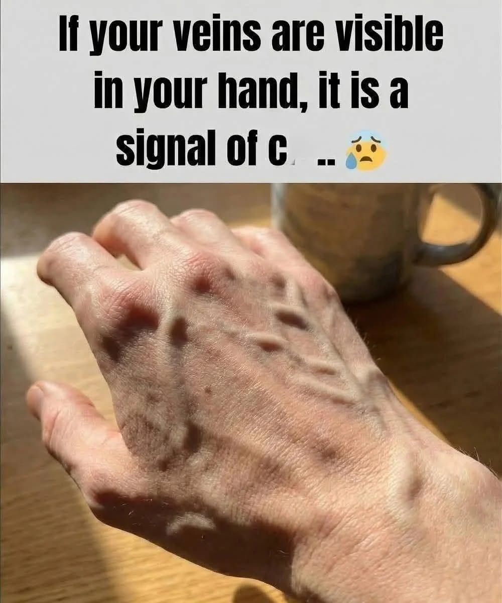 If your veins are visible, it means you are… See more
