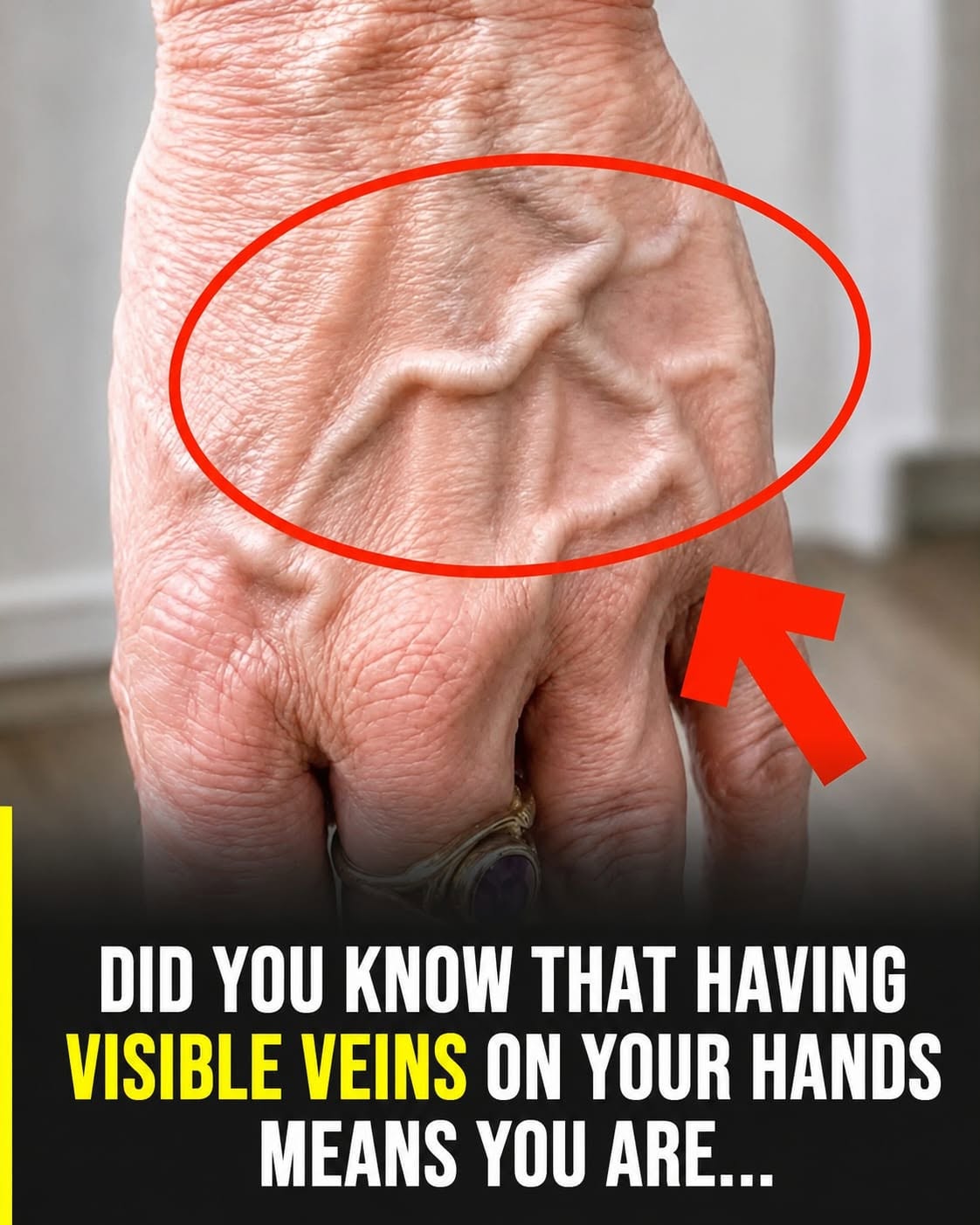 What Does It Mean If You Have Visible Veins? Here’s What You Should Know