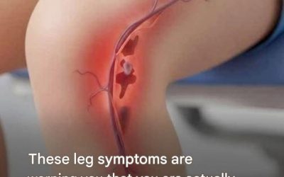 Symptoms that warn you of a severe thrombosis…See more