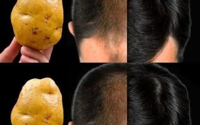 Potato for Hair: Can This Traditional Home Remedy Support Healthier Hair?