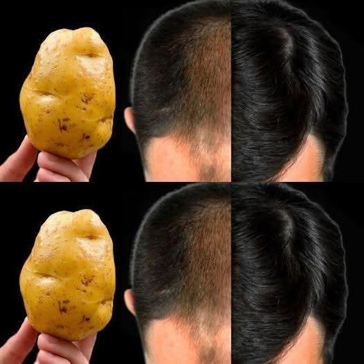 Potato for Hair: Can This Traditional Home Remedy Support Healthier Hair?