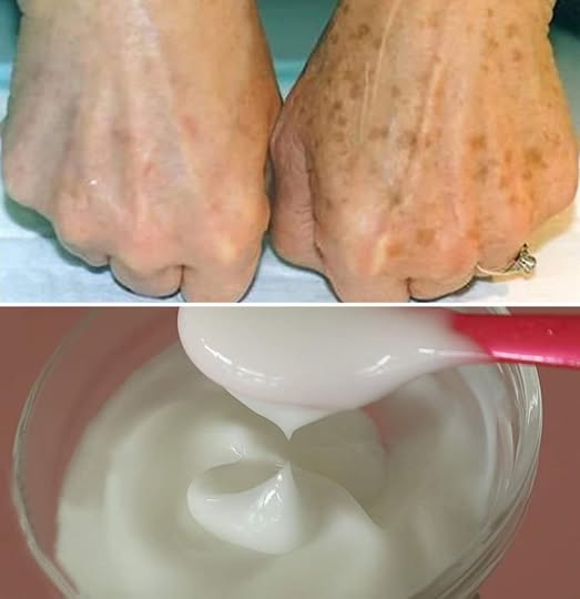 The Most Effective Cream Ingredients for Dark Spots and Signs of Skin Aging