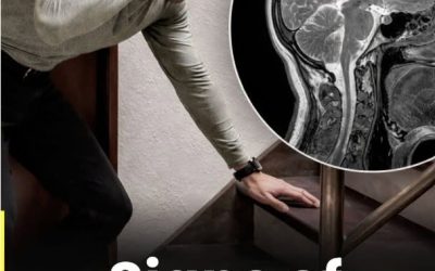Signs of Aneurysm…See more in 1st comment!