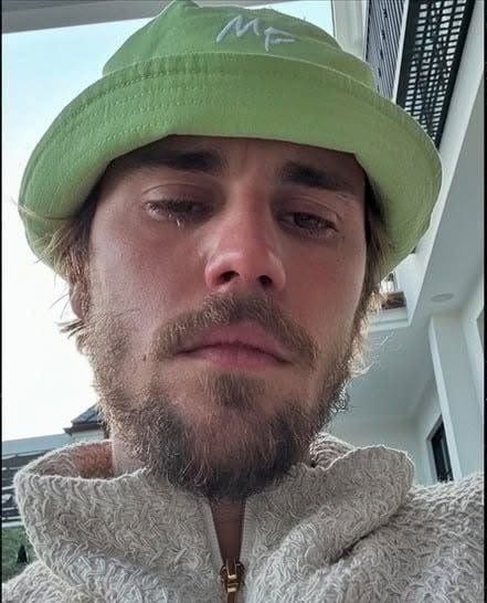 🥺Justin Bieber admits that he tested positive for…See More