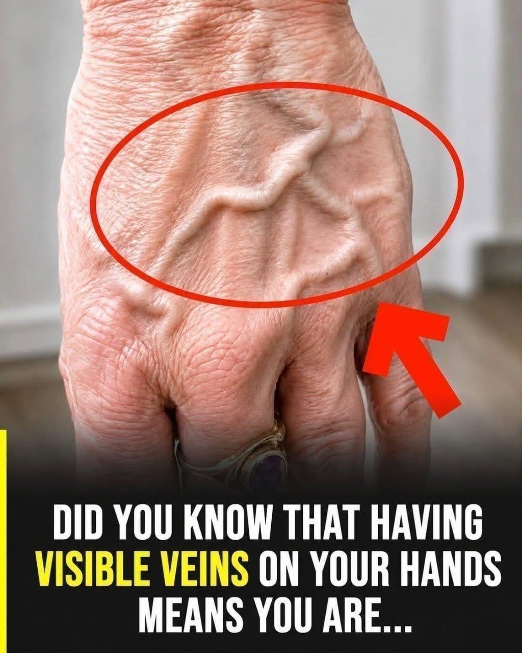 Did you know that having visible veins means you are