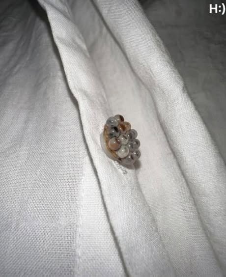 I found these tiny balls in my bed and nearly had a heart att.ack: here’s what they were