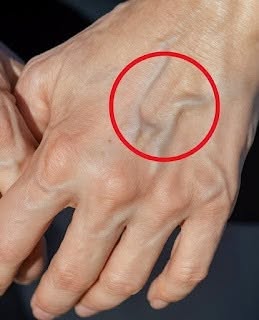 If you have visible veins, it means you are… See more