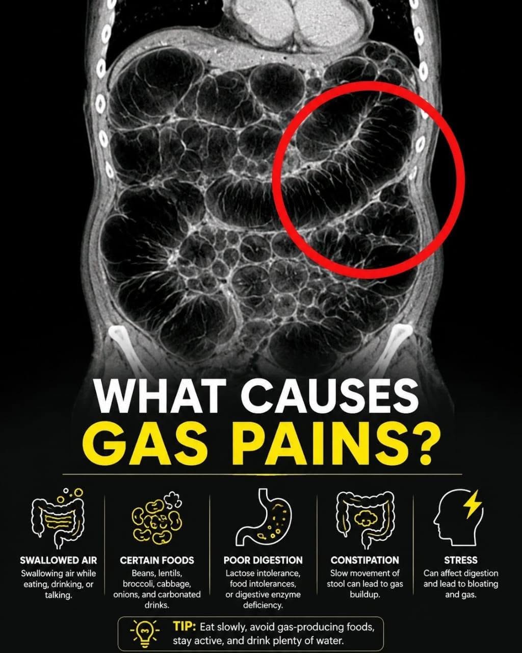 Frequent Intestinal Gas: Common Causes, Hidden Triggers, and Ways to Reduce Discomfort