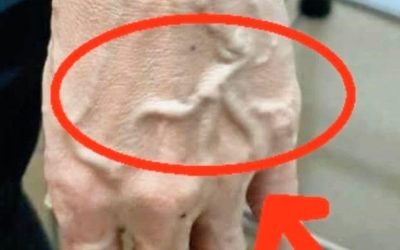 Did you know that having visible veins means you are… See more