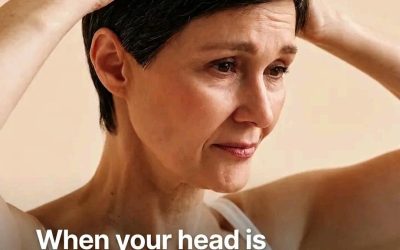 What Does an Itchy Scalp Mean? Common Causes and How to Find Relief