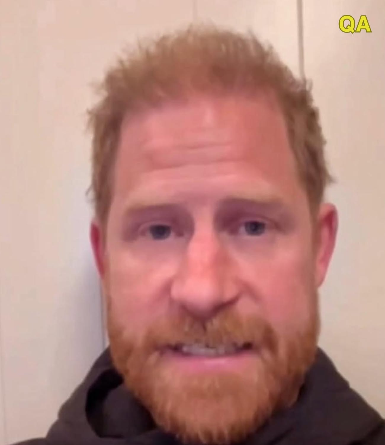 F. SHOCKING NEWS — 1 HOUR AGO! Just in from the U.S., Prince Harry Has Been Confirmed to Be