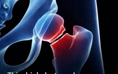 The five drinks that are most harmful to your bones, according to health experts.