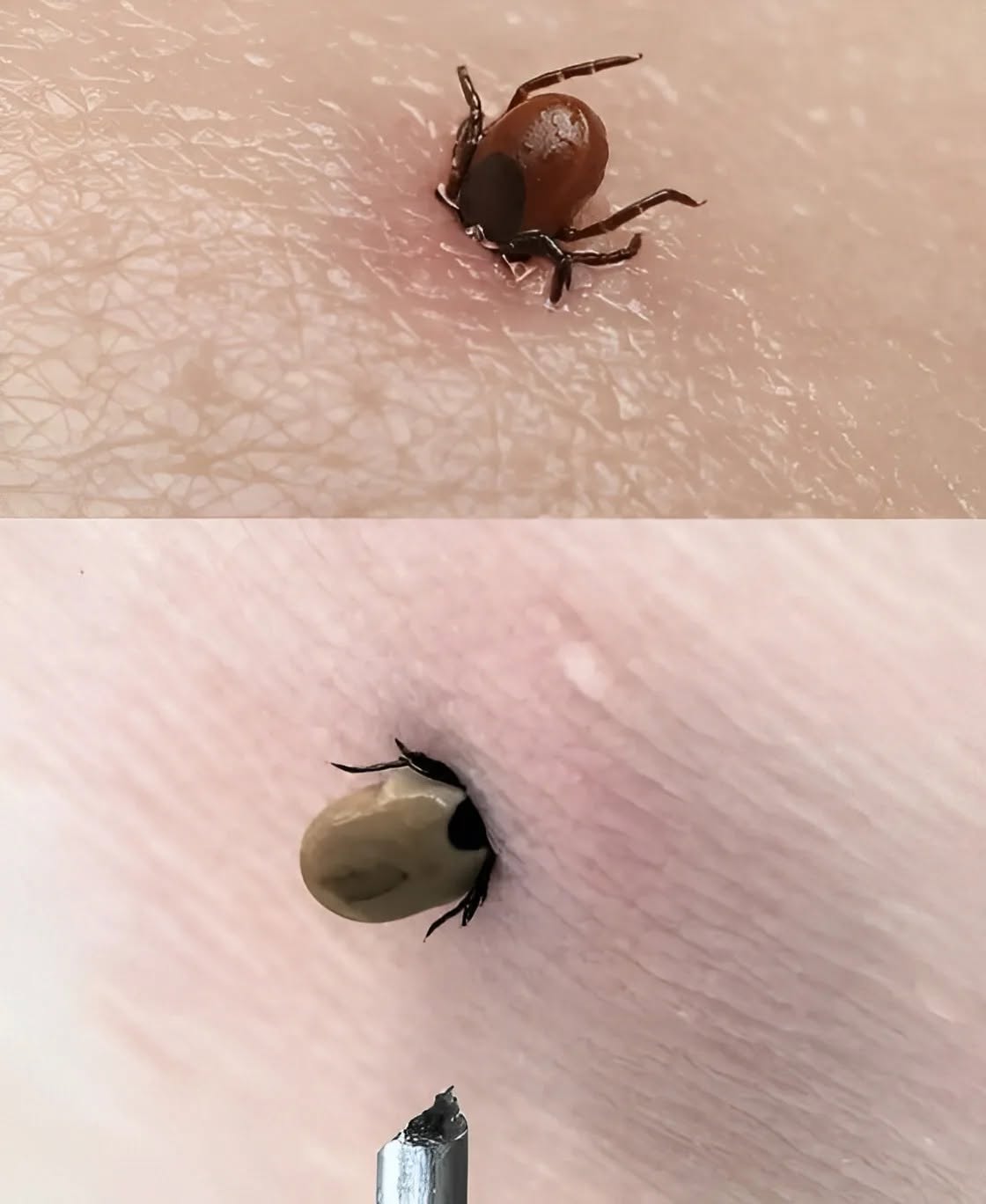 Never try to remove a tick with oil. ⛔️A doctor showed how to remove a tick correctly and extremely quickly — not even a minute has passed.