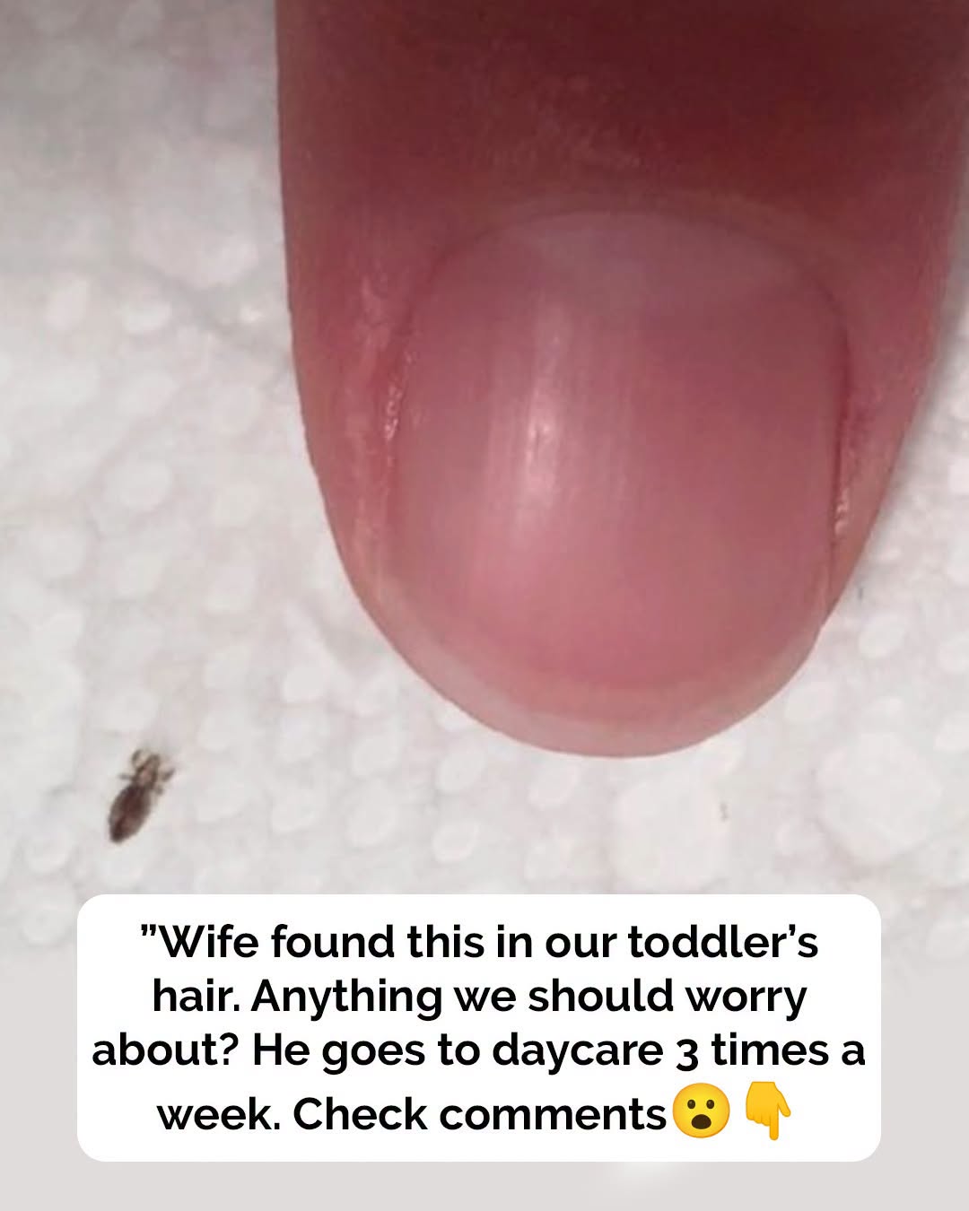 Head lice: How to get rid of them and stop them coming back