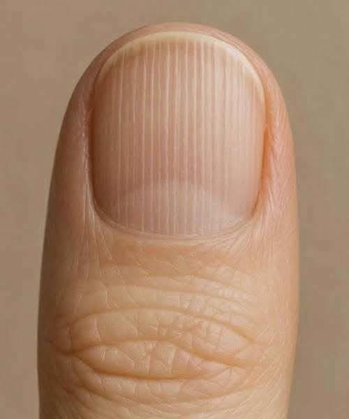 If you have lines on your nails, it means you have ca…See more😯⤵️